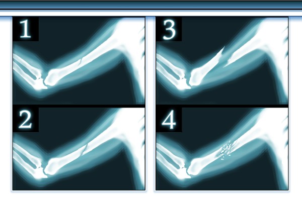 【画像性格占い】レントゲン写真を見て、性格を診断しちゃいます「あなたのダメージはどれくらい？」